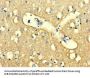 WDR27 Antibody
