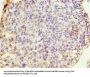 WDR62 Antibody