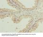 WDR91 Antibody