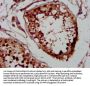 NSD2 Antibody