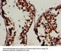 WIF1 Antibody
