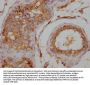 WISP2 Antibody