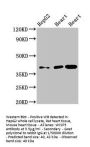 WISP3 Antibody