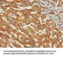 WISP3 Antibody