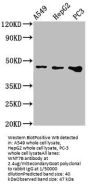 WNT7B Antibody