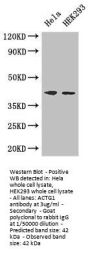 ACTG1 Antibody