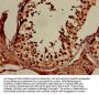 XPO1 Antibody