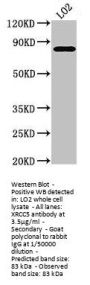 XRCC5 Antibody