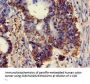 XRCC5 Antibody