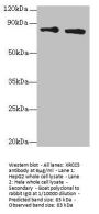 XRCC5 Antibody