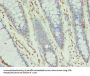 XRCC5 Antibody