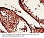 YES1 Antibody
