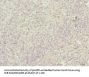 M6PR Antibody