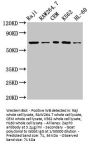 Zap70 Antibody