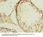 ZBTB43 Antibody