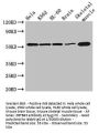 ZBTB43 Antibody