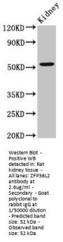 ZFP36L2 Antibody
