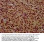 ZFX Antibody