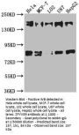 ZFYVE9 Antibody