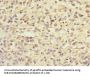 ZIC3 Antibody