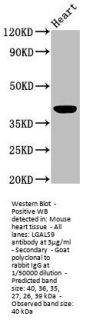 LGALS9 Antibody