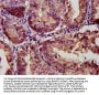 LGALS9 Antibody