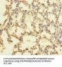 ZNF114 Antibody