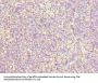 ZNF131 Antibody