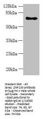 ZNF133 Antibody