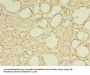 ZNF133 Antibody