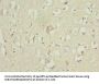 ZNF148 Antibody