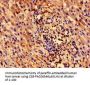 ZNF155 Antibody