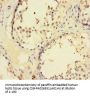ZNF165 Antibody