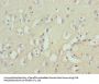 ZNF177 Antibody