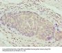 ZNF177 Antibody