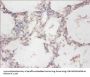 CYB5R3 Antibody