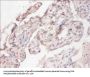 CYB5R3 Antibody