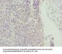 ZSCAN26 Antibody