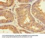 ZNF2 Antibody