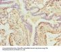 ZNF212 Antibody