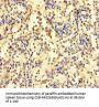 ZNF221 Antibody