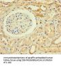 ZNF221 Antibody