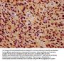 ZNF224 Antibody