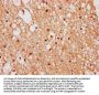 ZNF282 Antibody