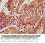 LTN1 Antibody