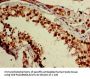 ZNF331 Antibody