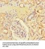 ZNF366 Antibody