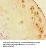 ZNF366 Antibody
