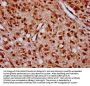 ZNF367 Antibody