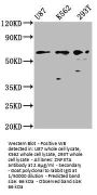 ZNF37A Antibody